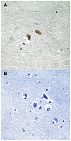 RAF1 (phospho T269), Rabbit anti-Human, Mouse, Polyclonal Antibody, Abnova 100 &mu;L | Buy Online | Abnova Corporation | Fisher Scientific