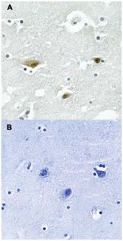 STK39 (phospho S325), Rabbit anti-Human, Mouse, Rat, Polyclonal Antibody,
