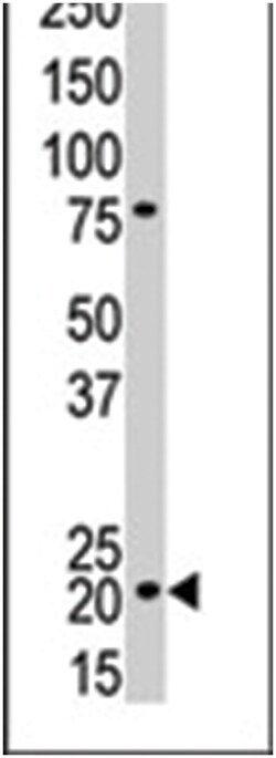 CDKN1A Rabbit anti-Human, Polyclonal Antibody, Abnova 400&mu;L; Unlabeled:Antibodies,