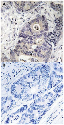 NOS2 (phospho Y151), Rabbit anti-Human, Mouse, Polyclonal Antibody, Abnova