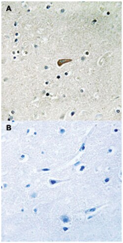 FRS2 (phospho Y436), Rabbit anti-Human, Mouse, Polyclonal Antibody, Abnova 100 &mu;L | Buy Online | Abnova Corporation | Fisher Scientific