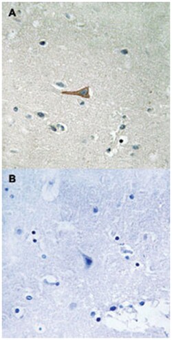 DDR1 (phospho Y513), Rabbit anti-Human, Mouse, Rat, Polyclonal Antibody,