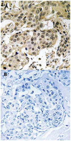 CBX5 (phospho S92), Rabbit anti-Human, Polyclonal Antibody, Abnova 100&mu;L;