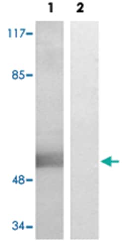 WWOX (phospho Y33), Rabbit anti-Human, Mouse, Polyclonal Antibody, Abnova 100 &mu;L | Buy Online | Abnova Corporation | Fisher Scientific