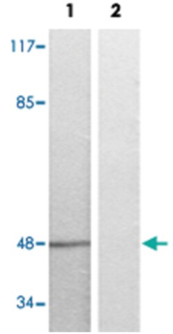 EFNB1/EFNB2/EFNB3, Rabbit, Polyclonal Antibody, Abnova 100&mu;L; Unlabeled:Antibodies,