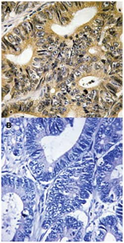 EIF4EBP1 (phospho T70), Rabbit anti-Human, Polyclonal Antibody, Abnova