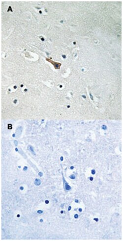 APLP2, Rabbit, Polyclonal Antibody, Abnova 100&mu;L; Unlabeled:Antibodies,