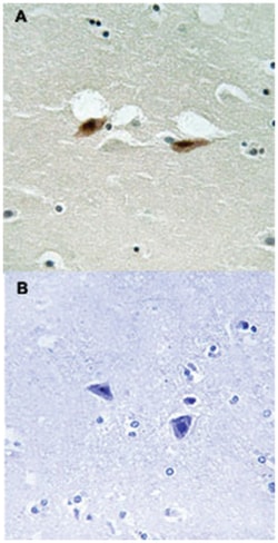 ATF2 (phospho S472), Rabbit anti-Human, Mouse, Rat, Polyclonal Antibody, Abnova 100 &mu;L | Buy Online | Abnova Corporation | Fisher Scientific