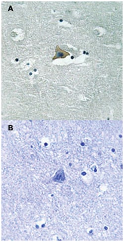 CLDN5 (phospho Y217), Rabbit anti-Human, Mouse, Rat, Polyclonal Antibody, Abnova 100 &mu;L | Buy Online | Abnova Corporation | Fisher Scientific