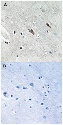GAB2 (phospho Y643), Rabbit anti-Human, Mouse, Rat, Polyclonal Antibody,