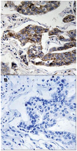 CCDC88A (phospho S1417), Rabbit anti-Human, Mouse, Polyclonal Antibody,