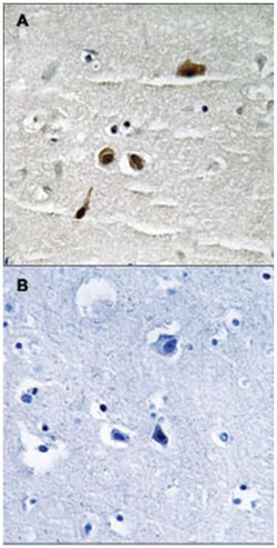 MDC1 (phospho S513), Rabbit anti-Human, Polyclonal Antibody, Abnova 100&mu;L;