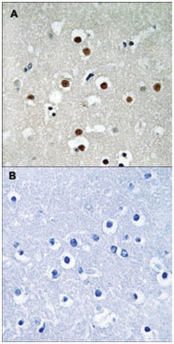 MEF2C (phospho S396), Rabbit anti-Human, Mouse, Polyclonal Antibody, Abnova
