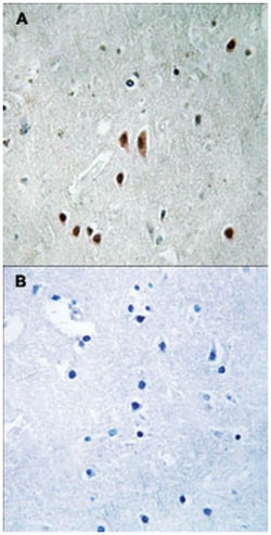 CNOT2, Rabbit, Polyclonal Antibody, Abnova 100 &mu;L | Buy Online | Abnova Corporation | Fisher Scientific