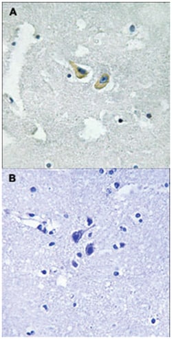 NCF1 (phospho S345), Rabbit anti-Human, Polyclonal Antibody, Abnova 100 &mu;L | Buy Online | Abnova | Fisher Scientific