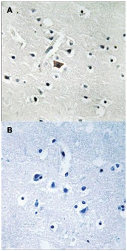 PLD2, Rabbit, Polyclonal Antibody, Abnova 100&mu;L; Unlabeled:Antibodies,