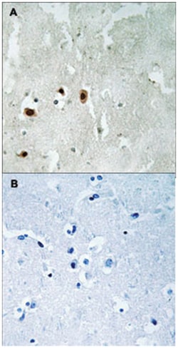 KAT5 (phospho S90), Rabbit anti-Human, Mouse, Rat, Polyclonal Antibody, Abnova 100 &mu;L | Buy Online | Abnova | Fisher Scientific