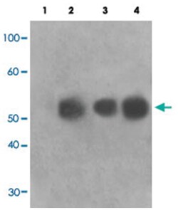 TOB1, Rabbit, Polyclonal Antibody, Abnova 100&mu;L; Unlabeled:Antibodies,