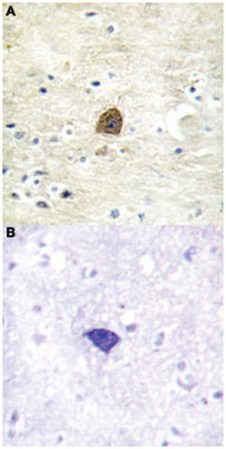 CAMK2A/CAMK2B/CAMK2D (phospho T305), Rabbit anti-Human, Mouse, Rat, Polyclonal