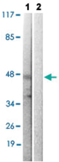 ARRB1 (phospho S412), Rabbit anti-Human, Mouse, Polyclonal Antibody, Abnova 100 &mu;L | Buy Online | Abnova | Fisher Scientific