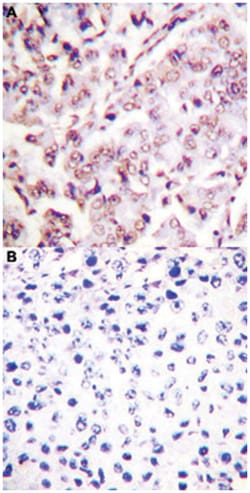 ETS1 (phospho T38), Rabbit anti-Human, Mouse, Rat, Polyclonal Antibody,