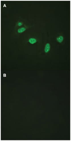 ETS1 (phospho T38), Rabbit anti-Human, Mouse, Rat, Polyclonal Antibody,