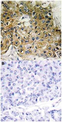 ITGB1 (phospho T789), Rabbit anti-Human, Mouse, Rat, Polyclonal Antibody, Abnova 100 &mu;L | Buy Online | Abnova | Fisher Scientific