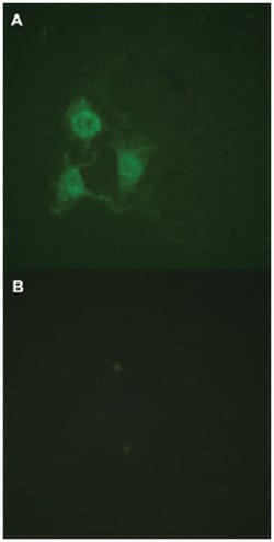 PRKACA/PRKACB, Rabbit, Polyclonal Antibody, Abnova 100&mu;L; Unlabeled:Antibodies,