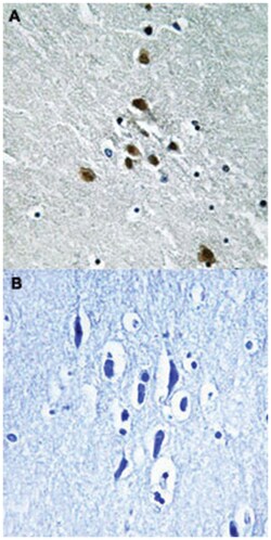 SF1 (phospho S82), Rabbit anti-Human, Mouse, Polyclonal Antibody, Abnova