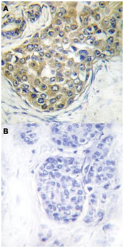TNK2 (phospho Y284), Rabbit anti-Human, Polyclonal Antibody, Abnova 100&mu;L;