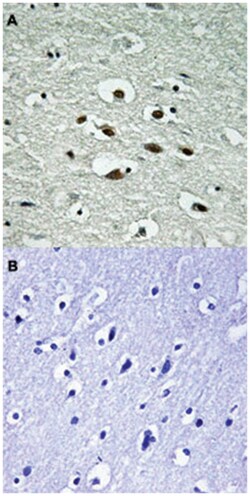 CHEK1 (phospho S296), Rabbit anti-Human, Mouse, Rat, Polyclonal Antibody, Abnova 100 &mu;L | Buy Online | Abnova Corporation | Fisher Scientific