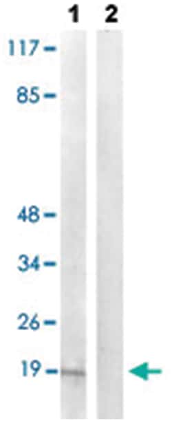 PEA15 (phospho S104), Rabbit anti-Human, Mouse, Rat, Polyclonal Antibody, Abnova 100 &mu;L | Buy Online | Abnova | Fisher Scientific
