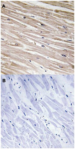 PEA15 (phospho S104), Rabbit anti-Human, Mouse, Rat, Polyclonal Antibody, Abnova 100 &mu;L | Buy Online | Abnova | Fisher Scientific