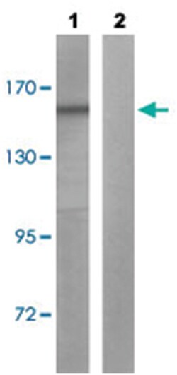 BLM (phospho T99), Rabbit anti-Human, Mouse, Rat, Polyclonal Antibody,