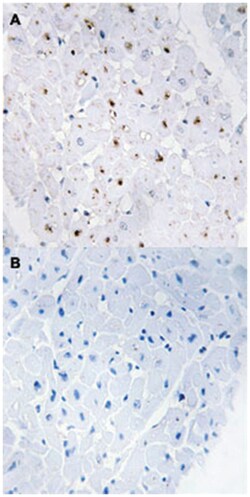 BLM (phospho T99), Rabbit anti-Human, Mouse, Rat, Polyclonal Antibody,