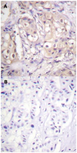 BRAF (phospho T599), Rabbit anti-Human, Mouse, Rat, Polyclonal Antibody,