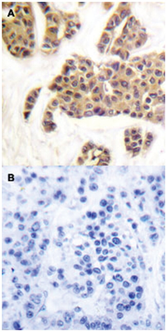 ANTIBAD ANTIBODY 100UL