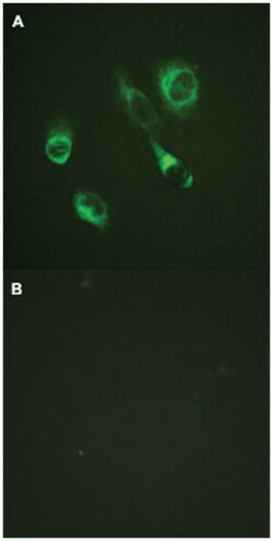 EPHA2/EPHA3/EPHA4 (phospho Y588/Y596), Rabbit anti-Human, Mouse, Polyclonal