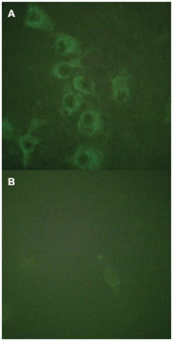 HRH1 (phospho S398), Rabbit anti-Human, Mouse, Polyclonal Antibody, Abnova 100 &mu;L | Buy Online | Abnova Corporation | Fisher Scientific