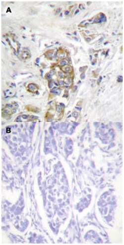 ITGB4 (phospho Y1510), Rabbit anti-Human, Mouse, Rat, Polyclonal Antibody,