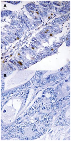 NR4A1 (phospho S351), Rabbit anti-Human, Polyclonal Antibody, Abnova 100 &mu;L | Buy Online | Abnova | Fisher Scientific
