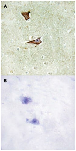 IGF2R (phospho S2409), Rabbit anti-Human, Mouse, Polyclonal Antibody, Abnova