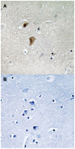 HSF1 (phospho T142), Rabbit anti-Human, Mouse, Rat, Polyclonal Antibody, Abnova 100 &mu;L | Buy Online | Abnova Corporation | Fisher Scientific