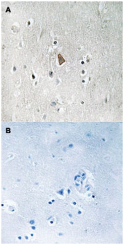 IGF1R (phospho Y1346), Rabbit anti-Human, Polyclonal Antibody, Abnova 100 &mu;L | Buy Online | Abnova | Fisher Scientific