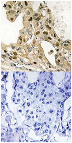 TP53 (phospho T387), Rabbit anti-Human, Polyclonal Antibody, Abnova 100&mu;L;