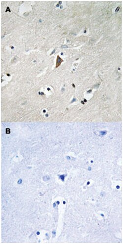PDPK1 (phospho Y9), Rabbit anti-Human, Mouse, Rat, Polyclonal Antibody,