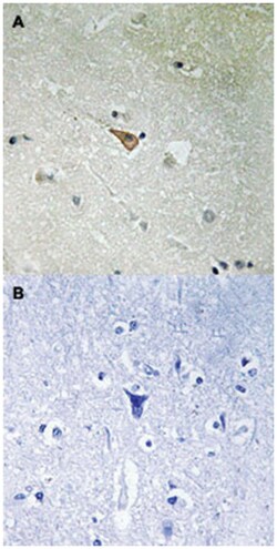 ALK (phospho Y1096), Rabbit anti-Human, Mouse, Polyclonal Antibody, Abnova