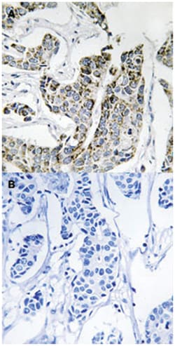 BLK (phospho Y501), Rabbit anti-Human, Mouse, Rat, Polyclonal Antibody, Abnova 100 &mu;L | Buy Online | Abnova Corporation | Fisher Scientific