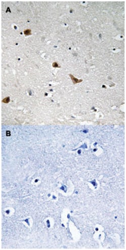 IKBKG (phospho S376), Rabbit anti-Human, Mouse, Rat, Polyclonal Antibody, Abnova 100 &mu;L | Buy Online | Abnova Corporation | Fisher Scientific