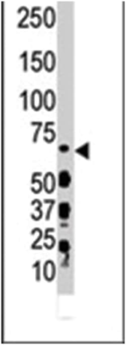 DYRK3 Rabbit anti-Human, Polyclonal Antibody, Abnova 400&mu;L; Unlabeled:Antibodies,
